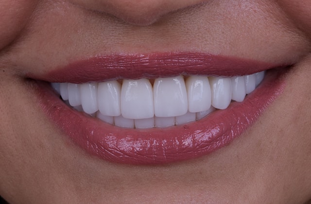 A result from Libby Dental