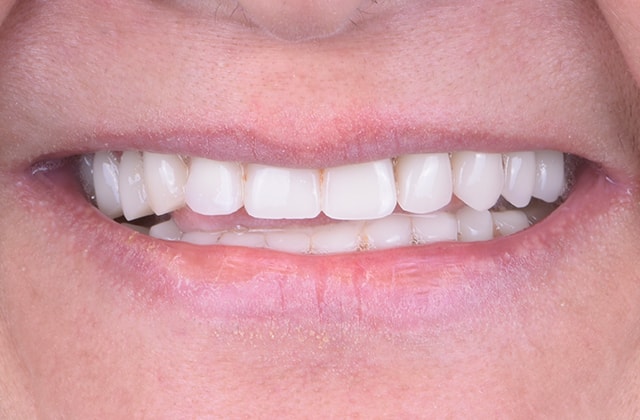 A result from Libby Dental