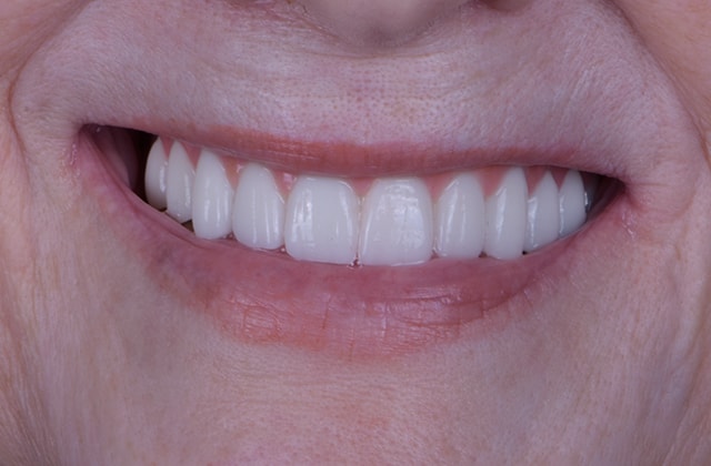 A result from Libby Dental