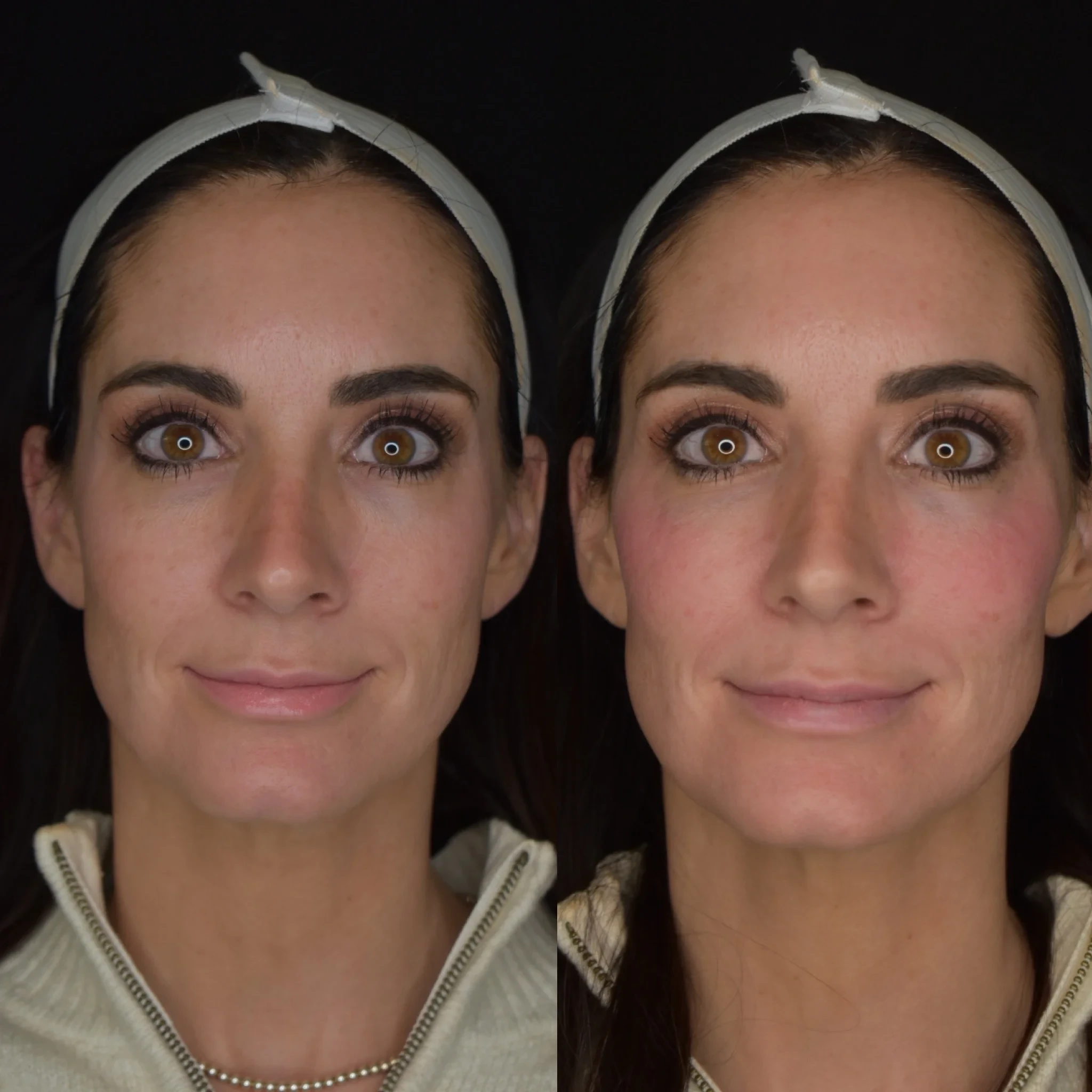 A result from Cosmedics MedSpa