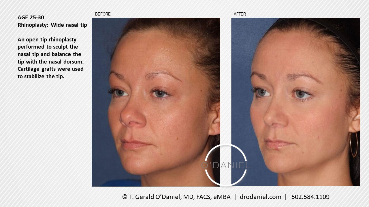 A result from O'Daniel Studios - T. Gerald O'Daniel, MD, FACS