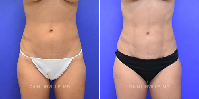 A result from Austin Face & Body