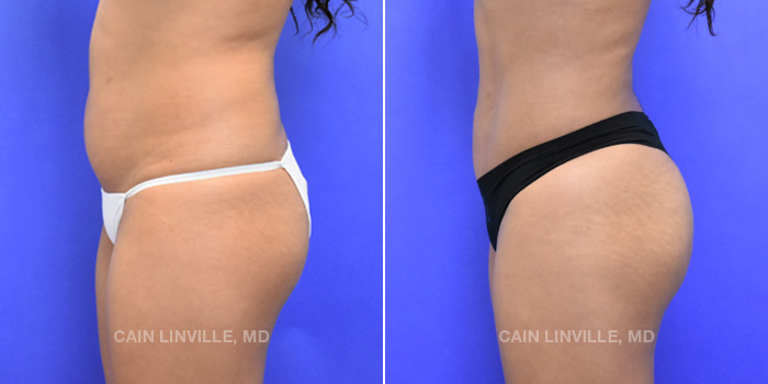 A result from Austin Face & Body