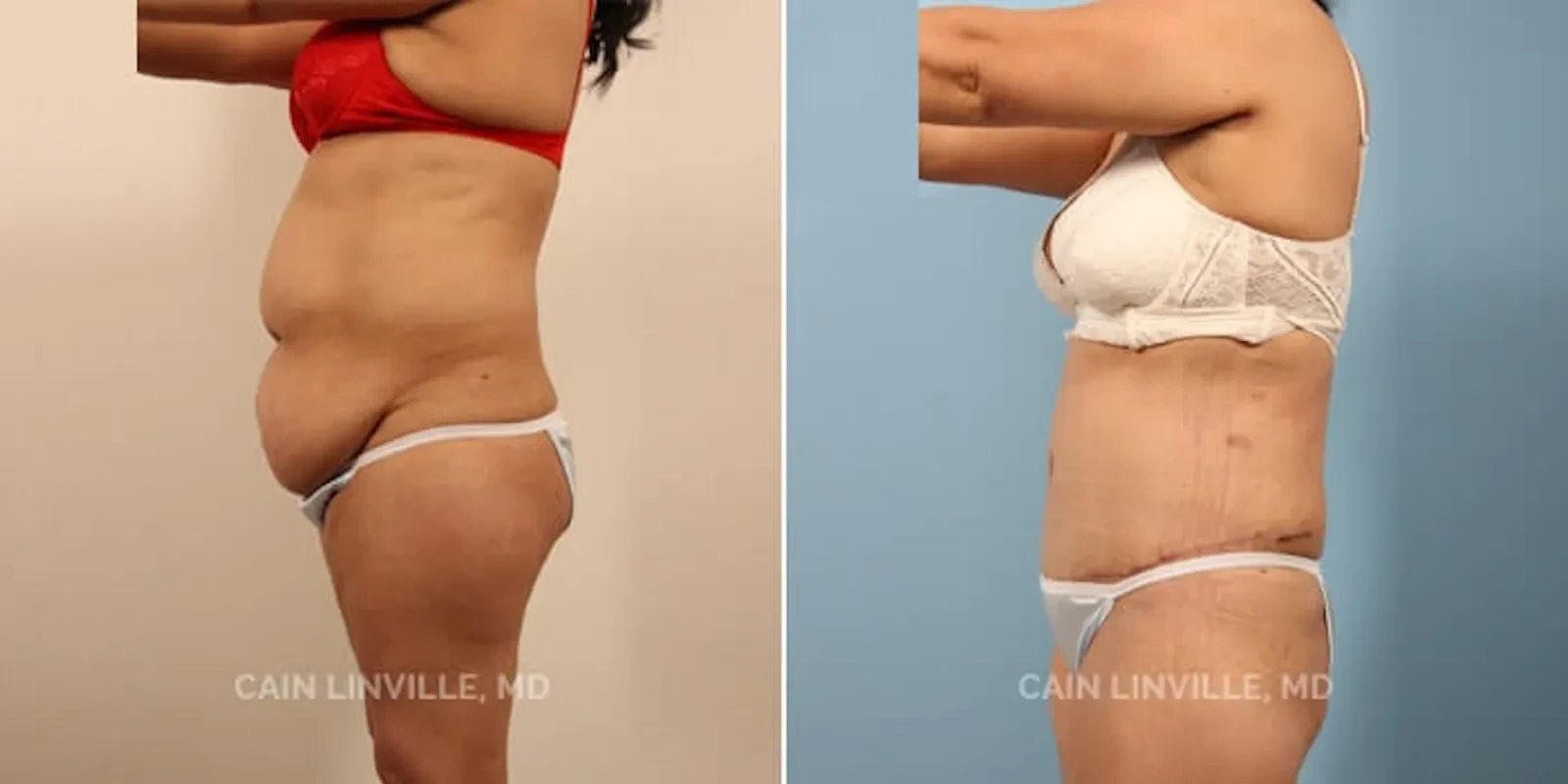 A result from Austin Face & Body