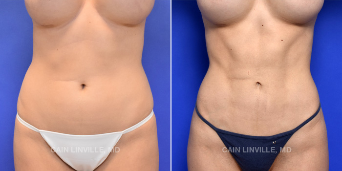 A result from Austin Face & Body