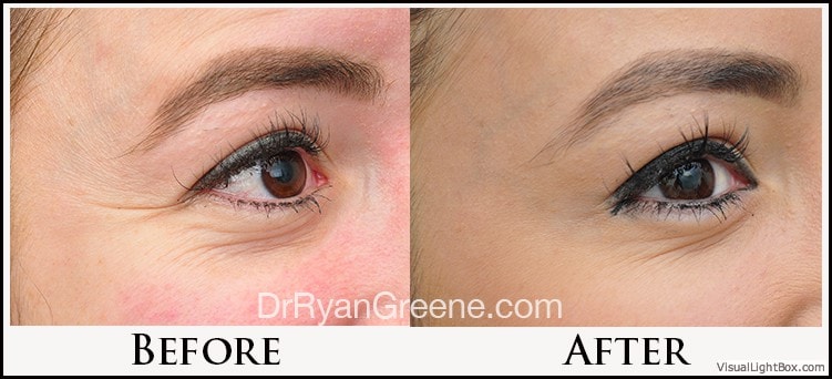 A result from Dr. Ryan Greene