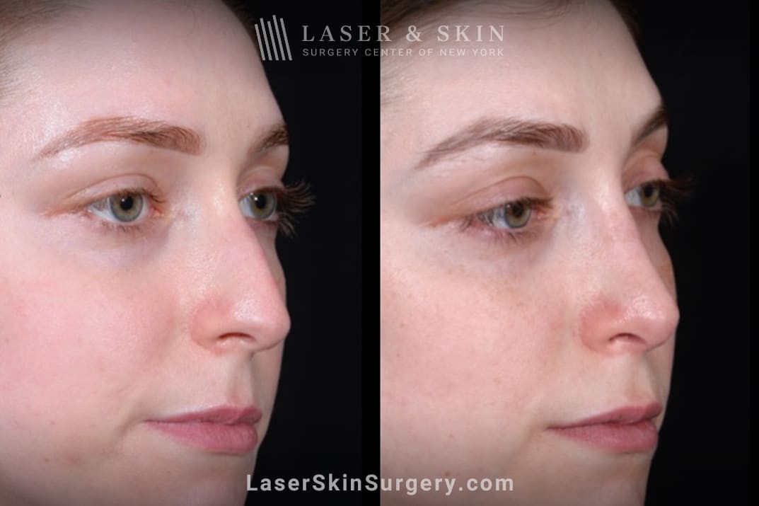 A result from Dr. Lloyd Hoffman