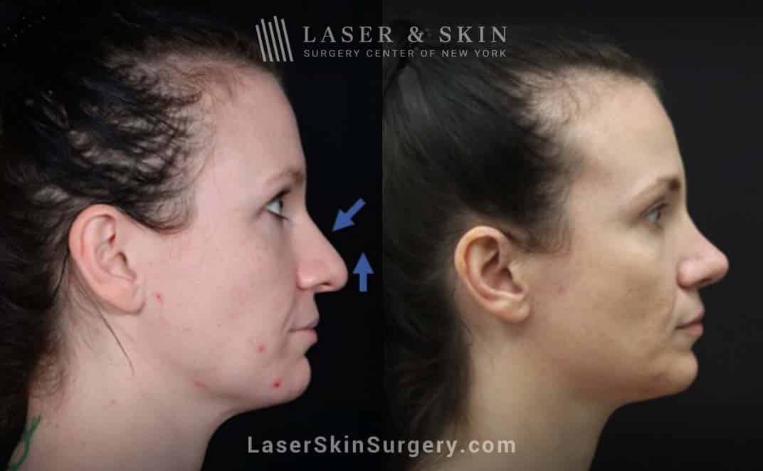 A result from Dr. Lloyd Hoffman