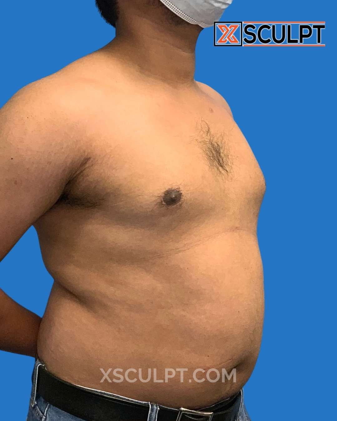 XSculpt provider photo