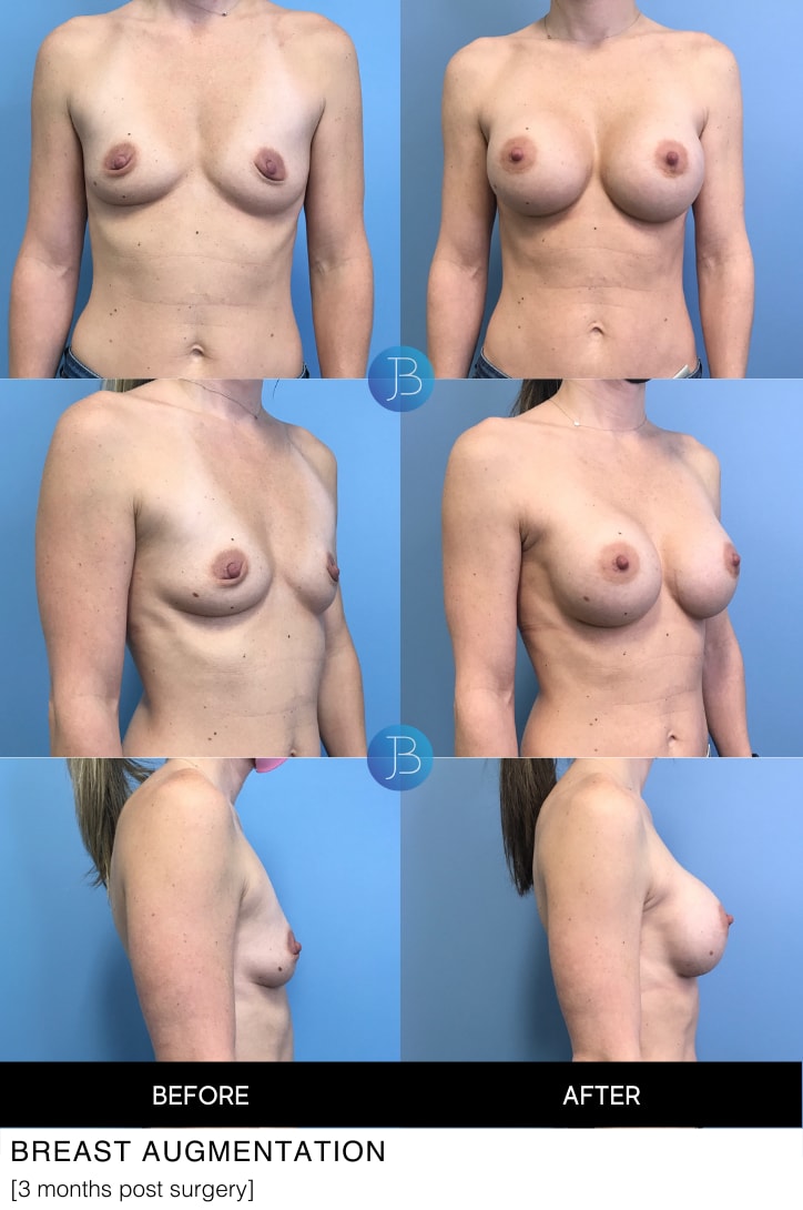 A result from Bloom Plastic Surgery