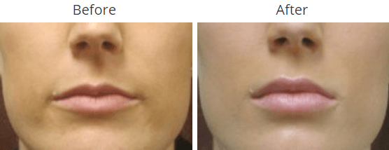 A result from Mimi Lee M.D. PA