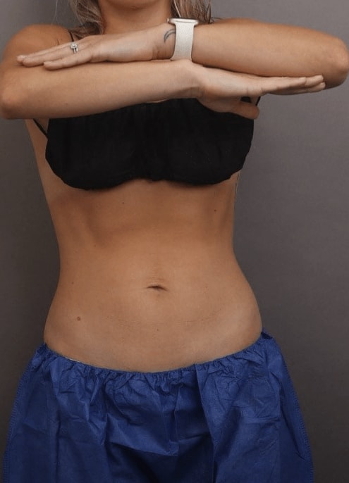A result from O'Neill Plastic Surgery