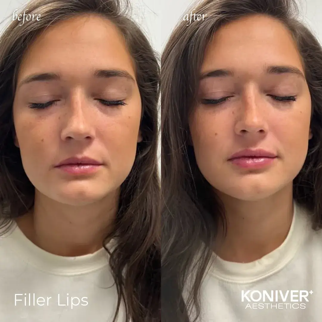 A result from Well Labs+ Medspa Charleston