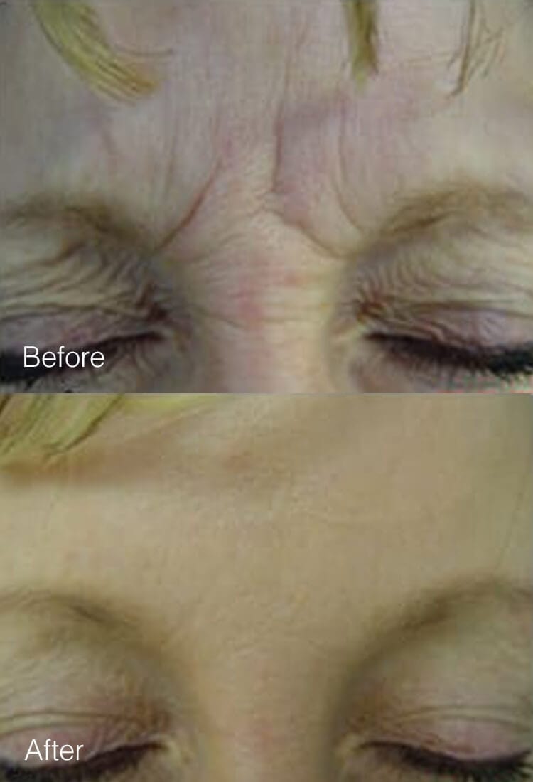 A result from West Plano Plastic Surgery Center