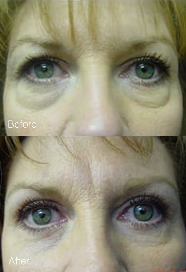 A result from West Plano Plastic Surgery Center