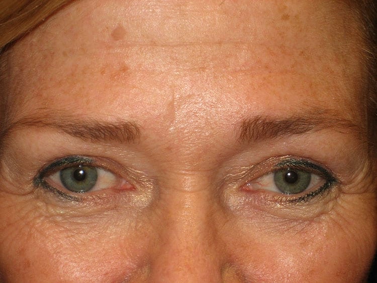 A result from Arnold S. Breitbart, MD