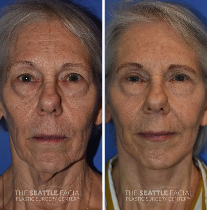 A result from Dr William Portuese