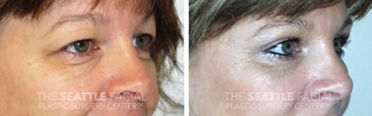 A result from Dr William Portuese
