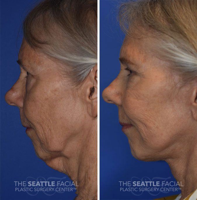 A result from Dr William Portuese