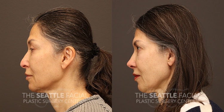 A result from Dr William Portuese
