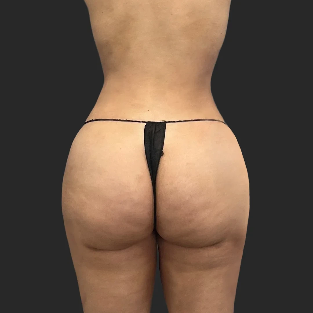 A result from Be That Beautiful