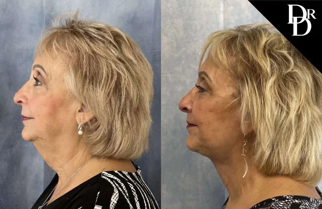 A result from Demetri Arnaoutakis, MD