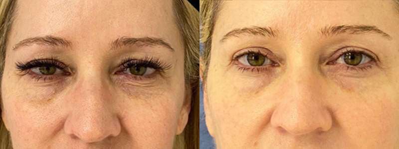 A result from Demetri Arnaoutakis, MD