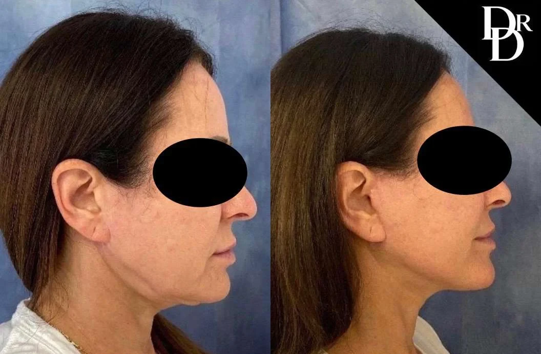 A result from Demetri Arnaoutakis, MD
