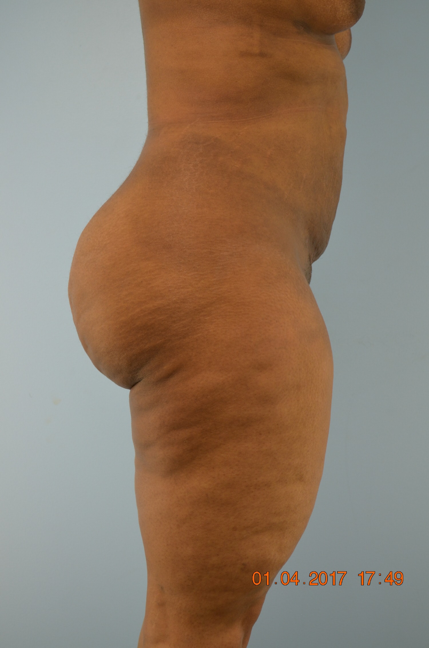 A result from Gillian Institute