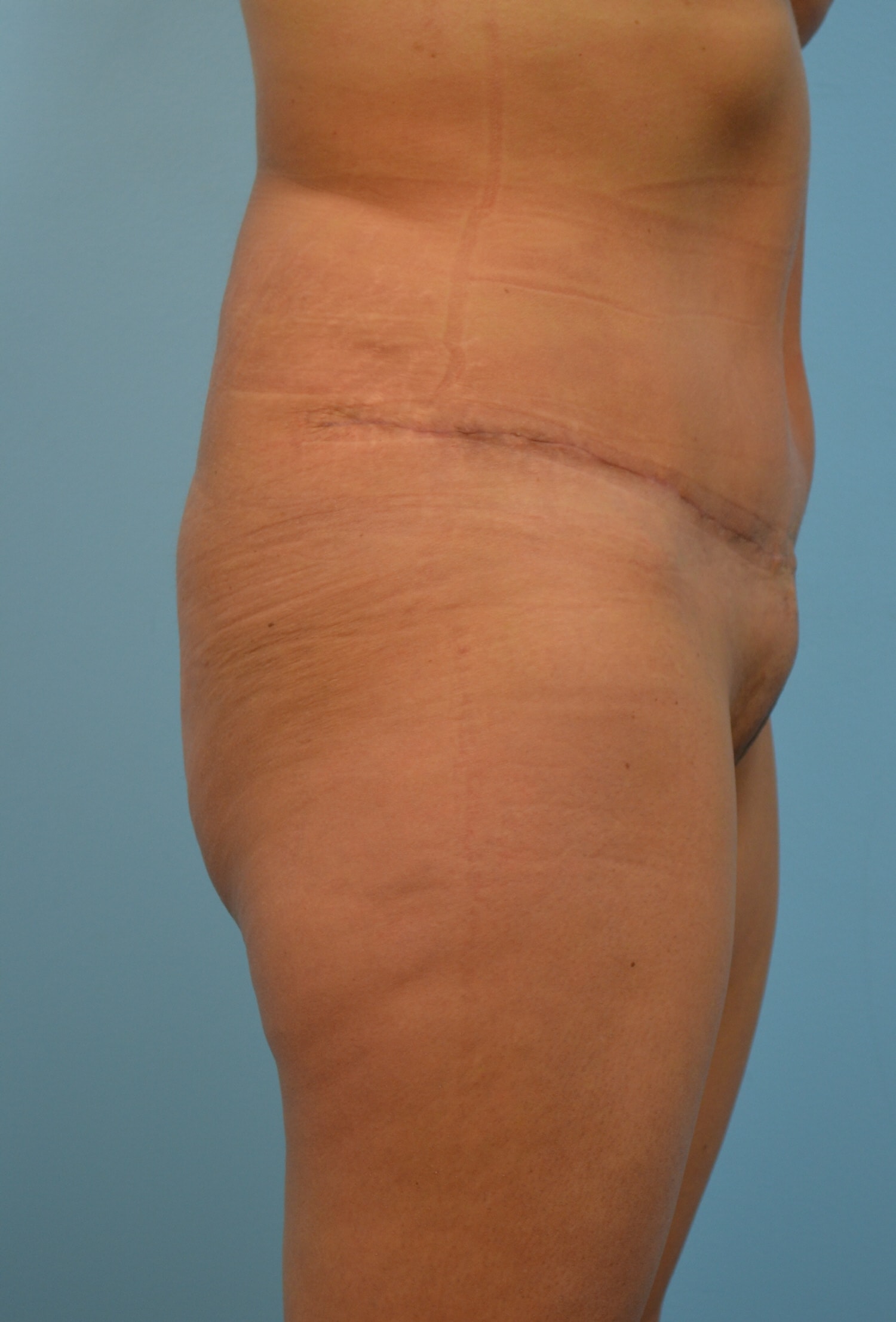 A result from Gillian Institute