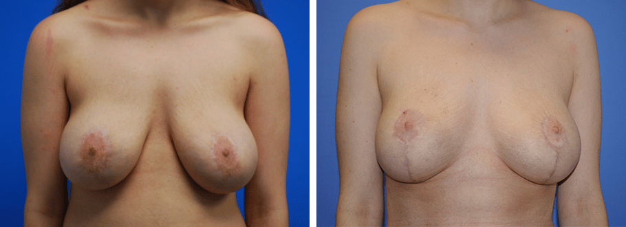 A result from ARTIS Institute - Dr. Sarraga