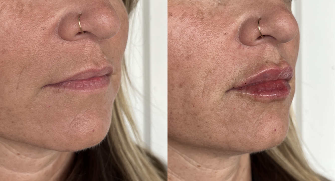 Laura Trapp Aesthetics provider photo