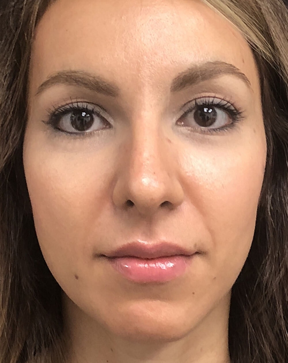 A result from John Minoli, MD