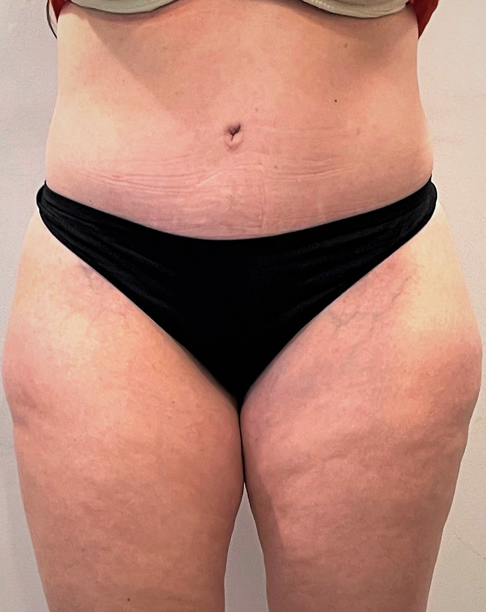 A result from John Minoli, MD