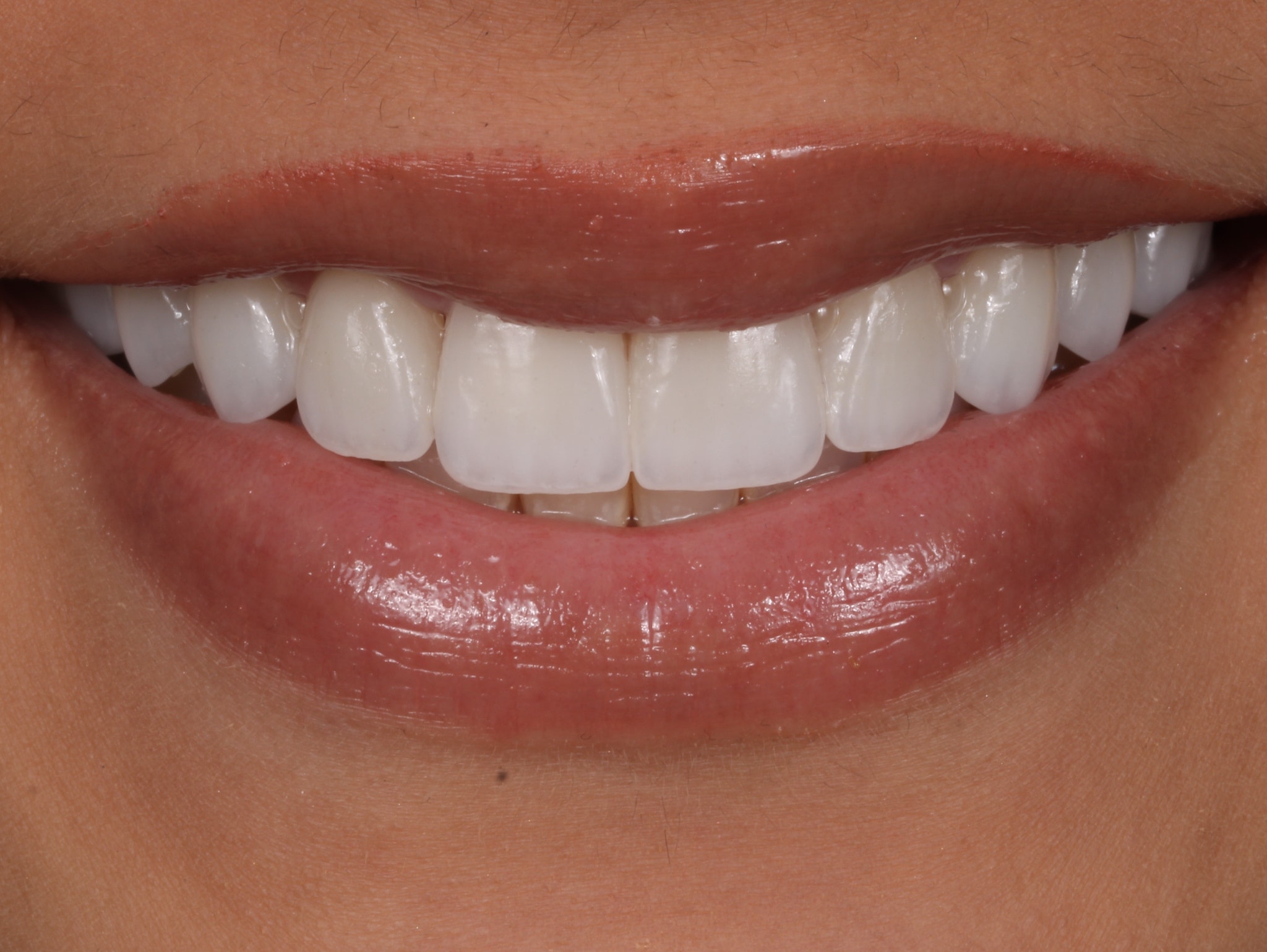 A result from Dr. Tyler Hales
