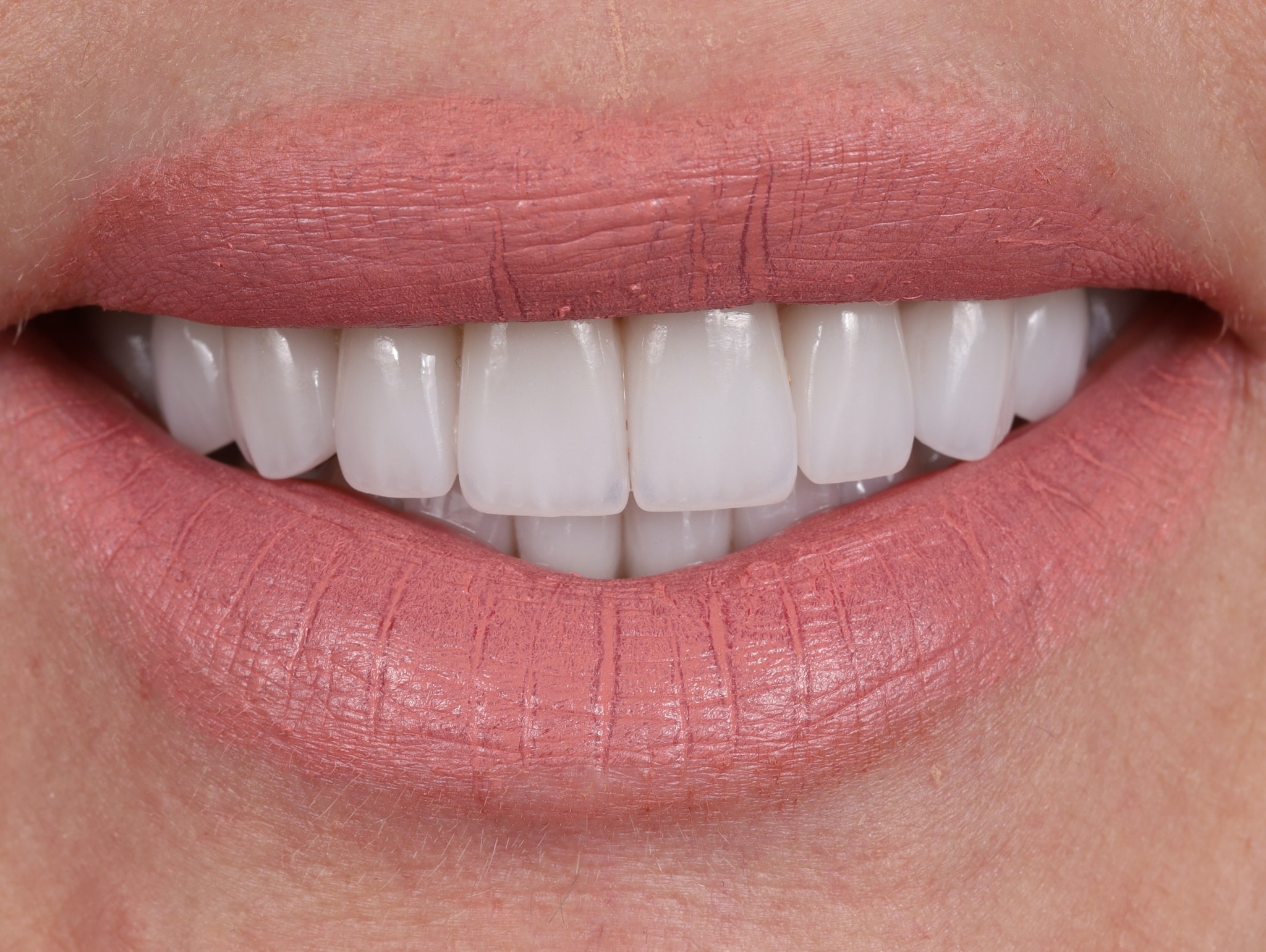 A result from Dr. Tyler Hales