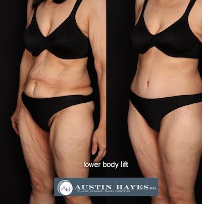 Austin Hayes, MD