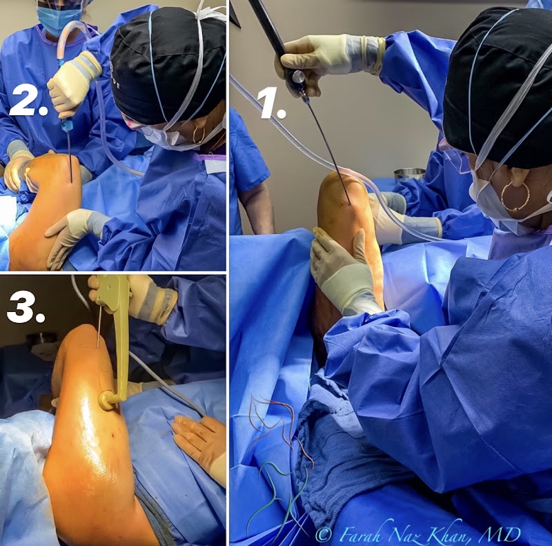 Khan Plastic Surgery